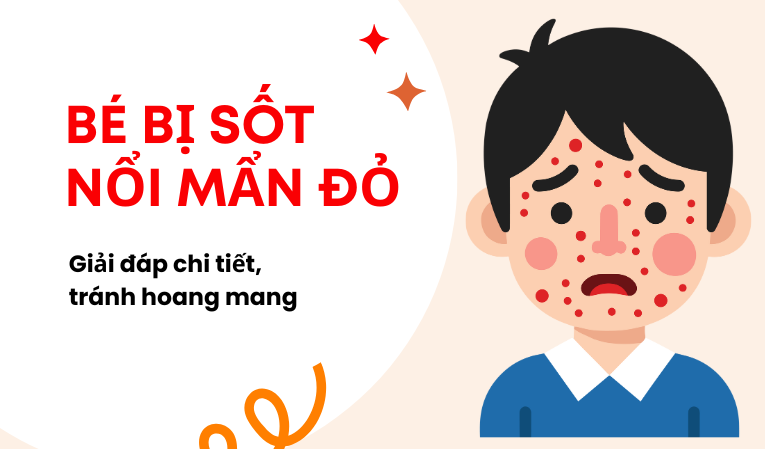 Bé bị sốt nổi mẩn đỏ: Giải đáp chi tiết, tránh hoang mang