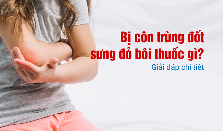 Bị côn trùng đốt sưng đỏ bôi thuốc gì? Giải đáp chi tiết