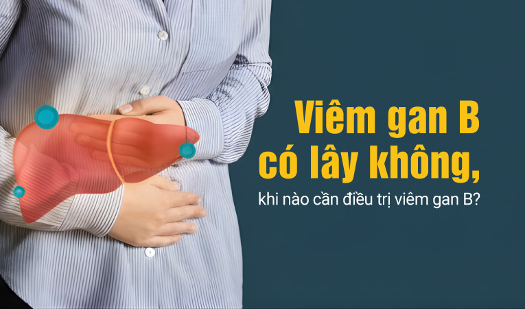 Viêm gan B có lây không, khi nào cần điều trị viêm gan B?