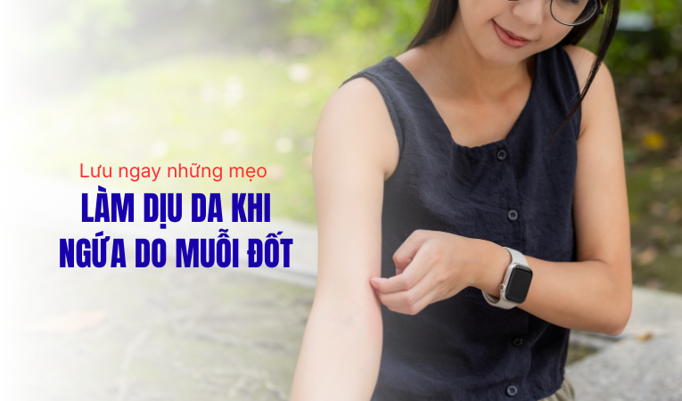 Lưu ngay 9 mẹo làm dịu da khi ngứa do muỗi đốt