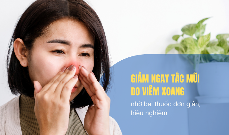 Giảm ngay tắc mũi do viêm xoang nhờ bài thuốc đơn giản, hiệu nghiệm