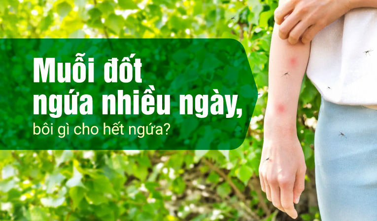 Muỗi đốt ngứa nhiều ngày, bôi gì cho hết ngứa?