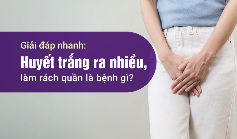 Giải đáp nhanh: Huyết trắng ra nhiều, làm rách quần là bệnh gì?