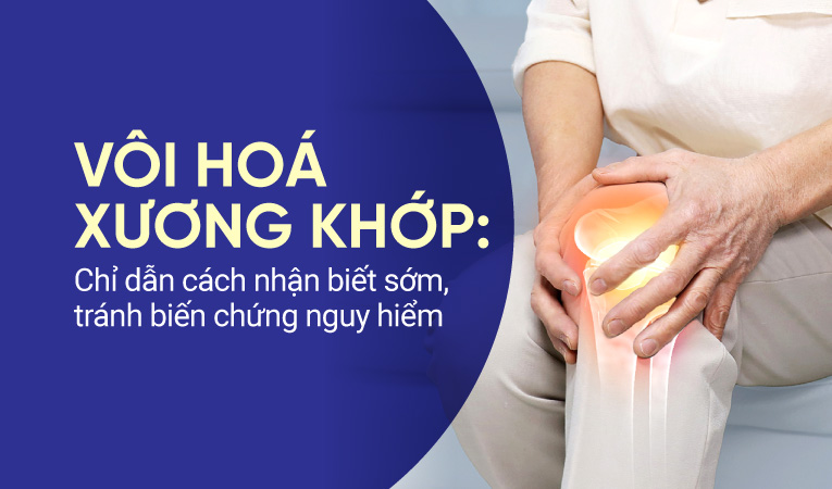 Vôi hoá xương khớp: Chỉ dẫn cách nhận biết sớm, tránh biến chứng nguy hiểm