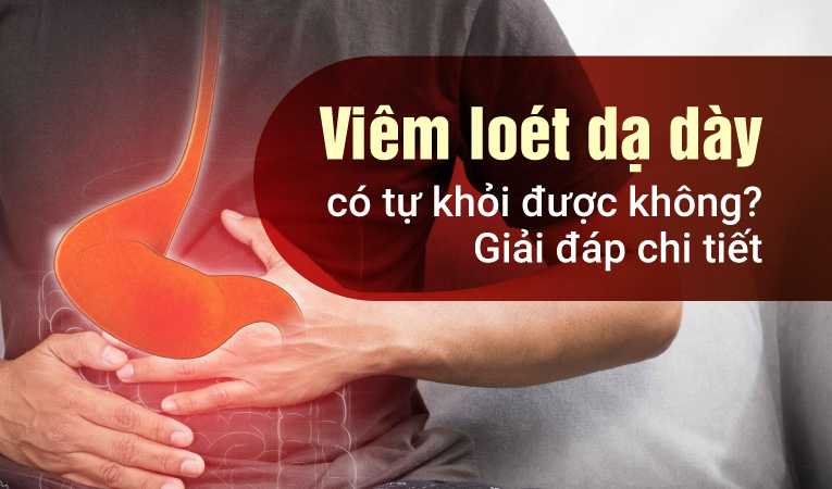 Viêm loét dạ dày có tự khỏi được không? Giải đáp chi tiết