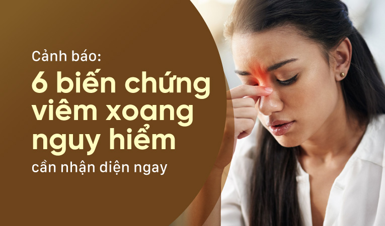Cảnh báo: 6 biến chứng viêm xoang nguy hiểm cần nhận diện ngay