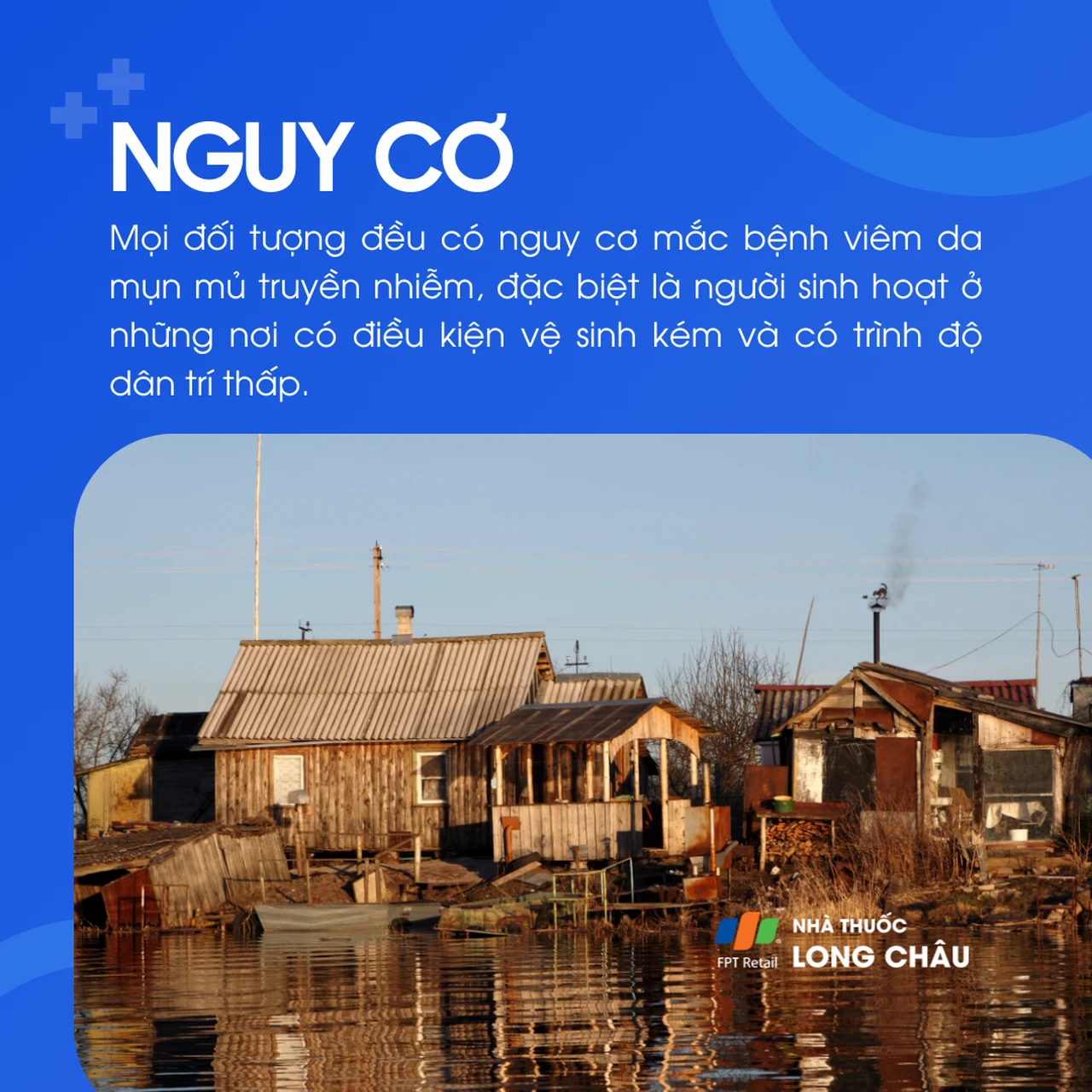Hình ảnh minh họa