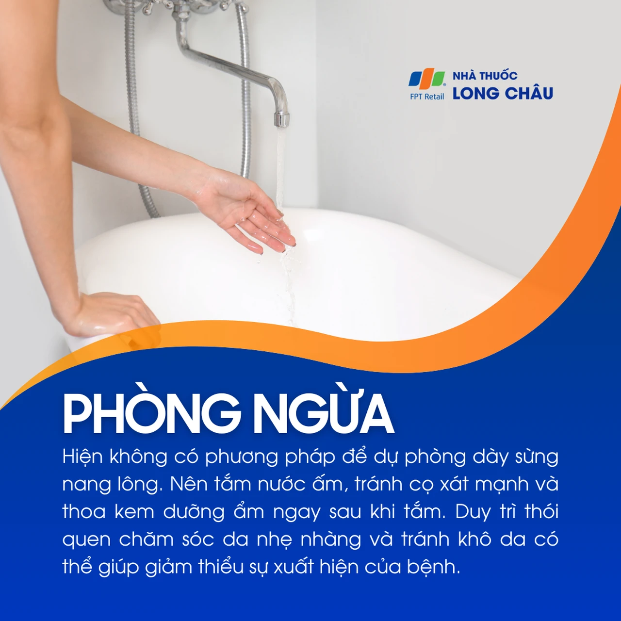 Hình ảnh minh họa