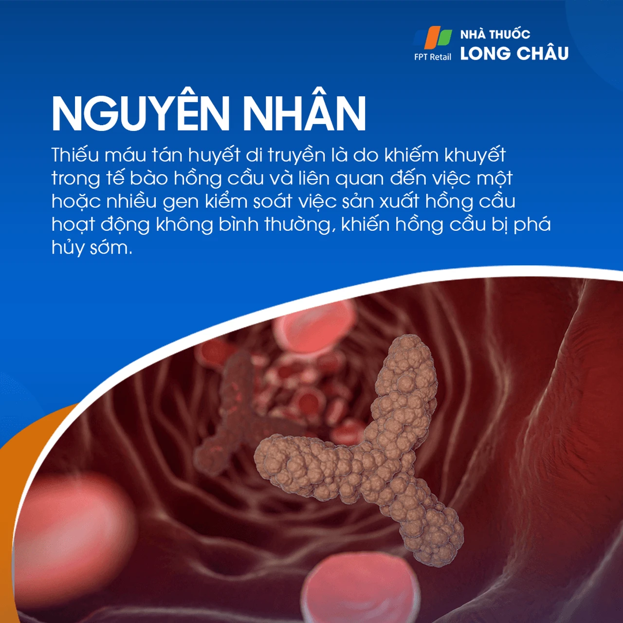 Hình ảnh minh họa