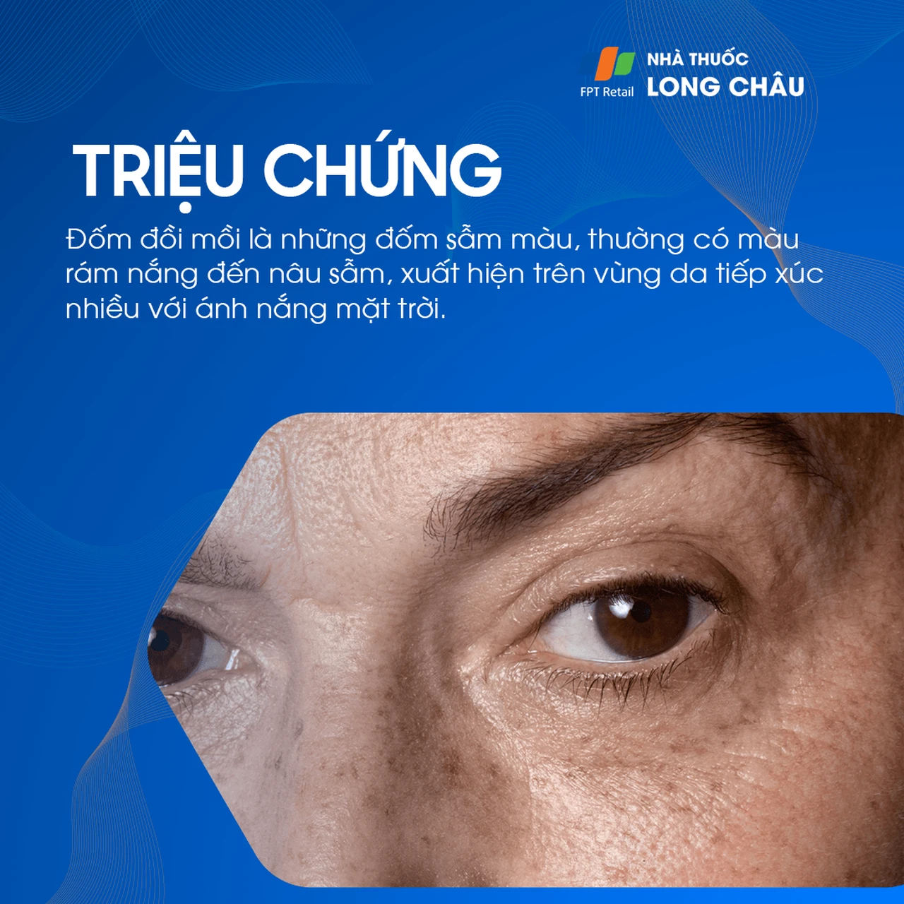 Hình ảnh minh họa