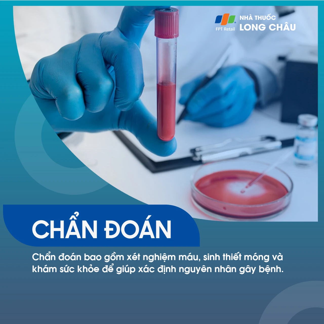 Hình ảnh minh họa