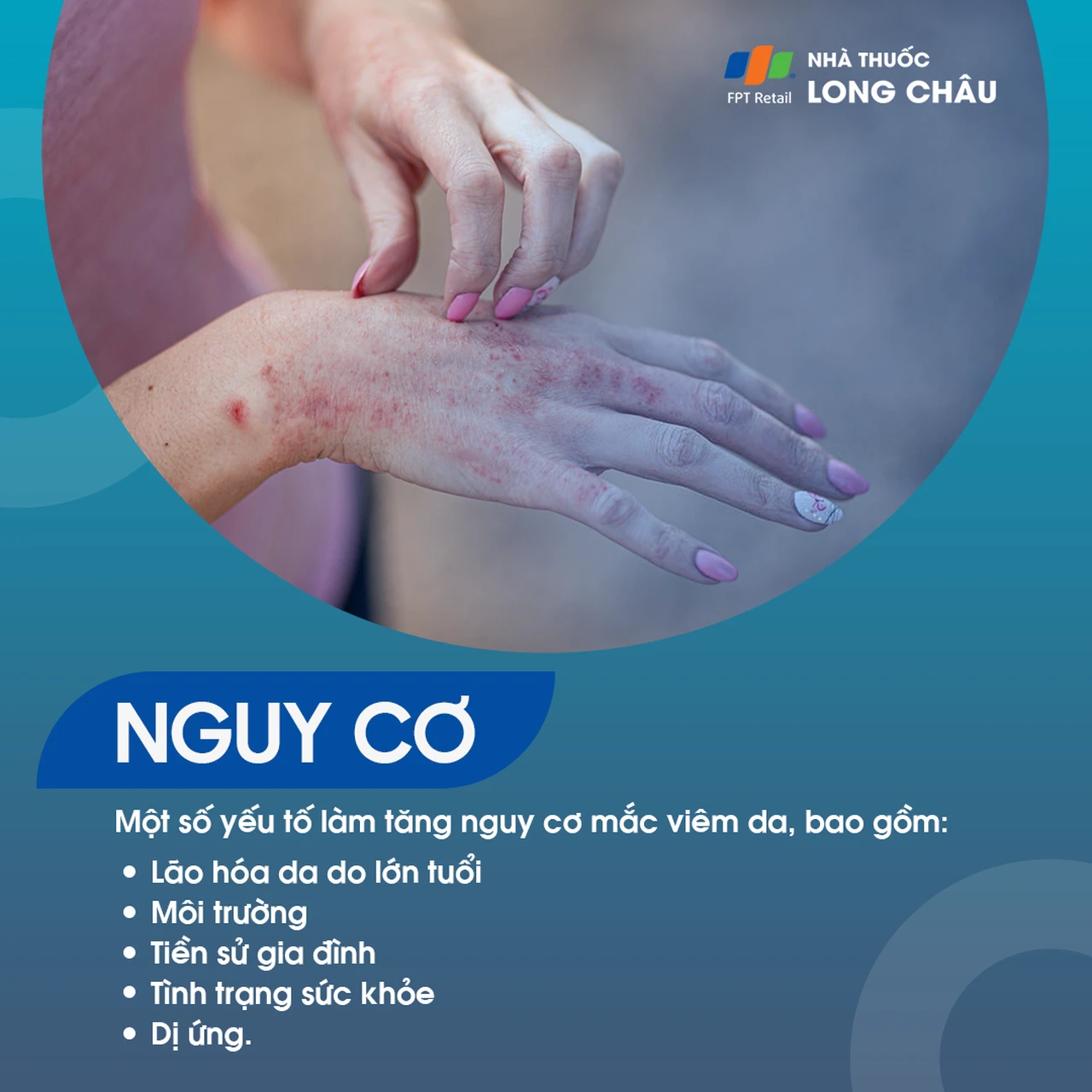 Hình ảnh minh họa