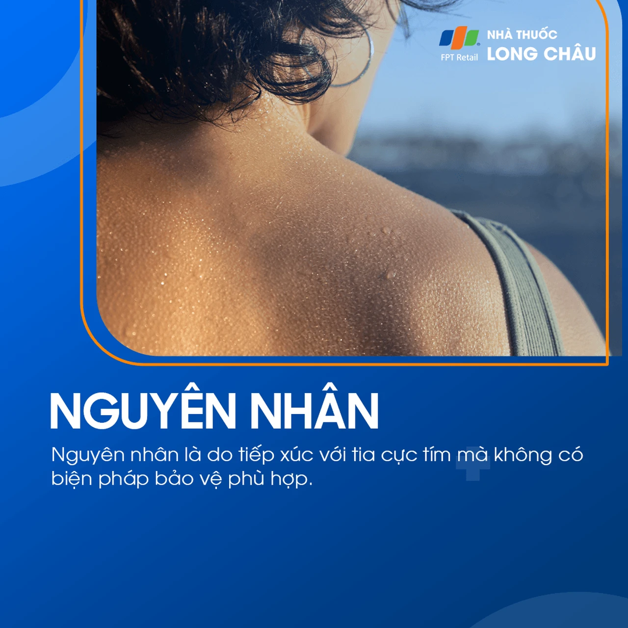 Hình ảnh minh họa