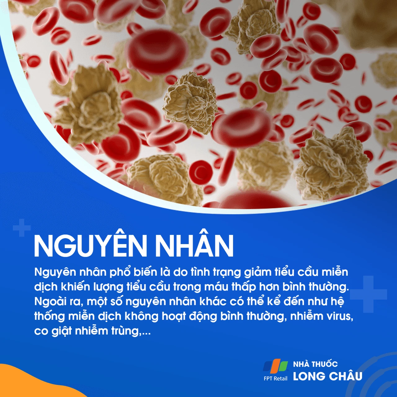 Hình ảnh minh họa