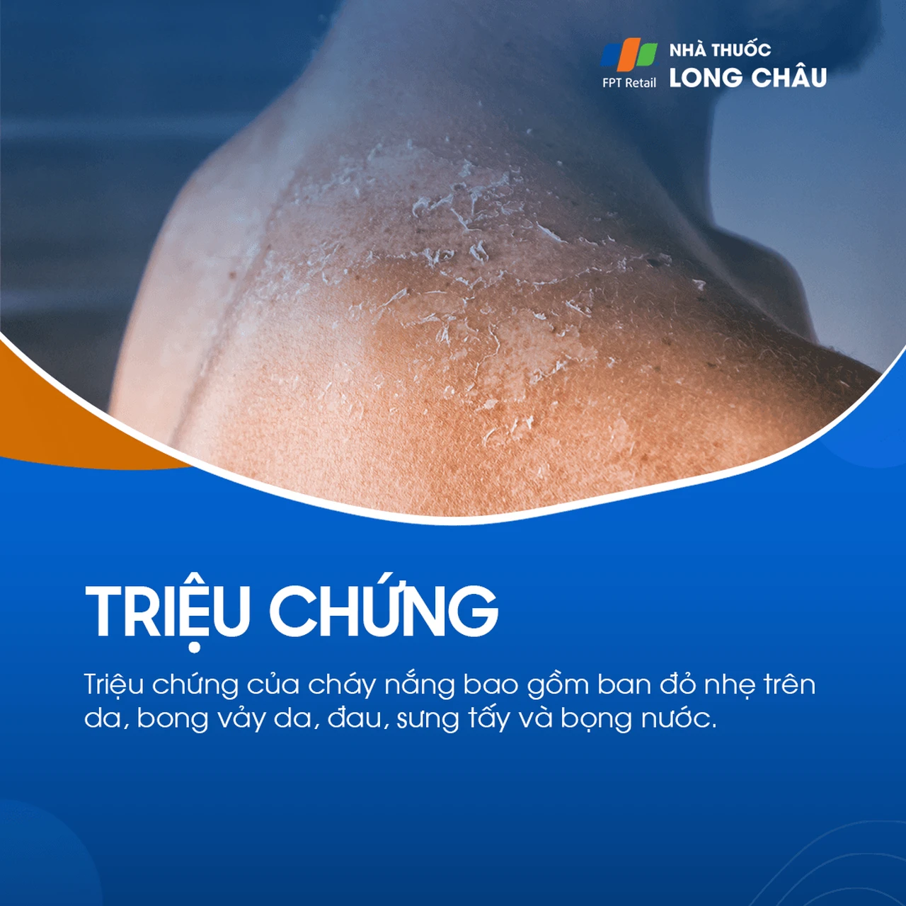 Hình ảnh minh họa