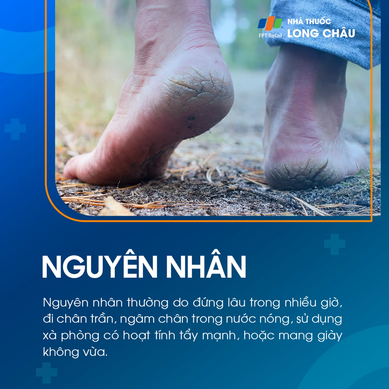 Hình ảnh minh họa