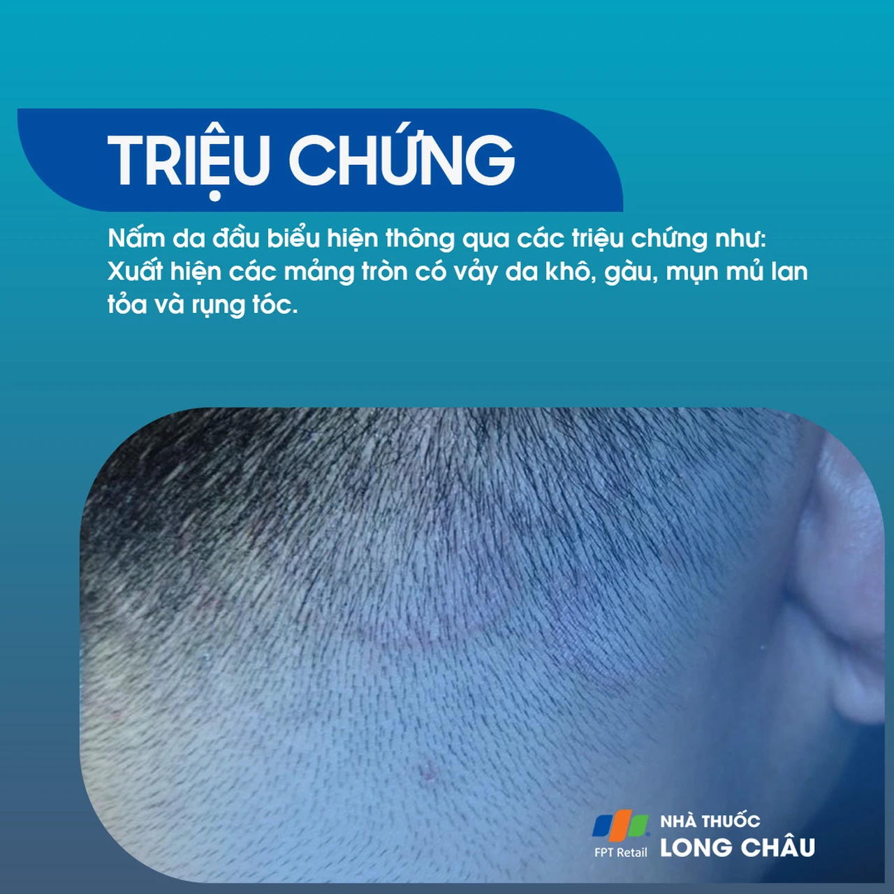 Hình ảnh minh họa