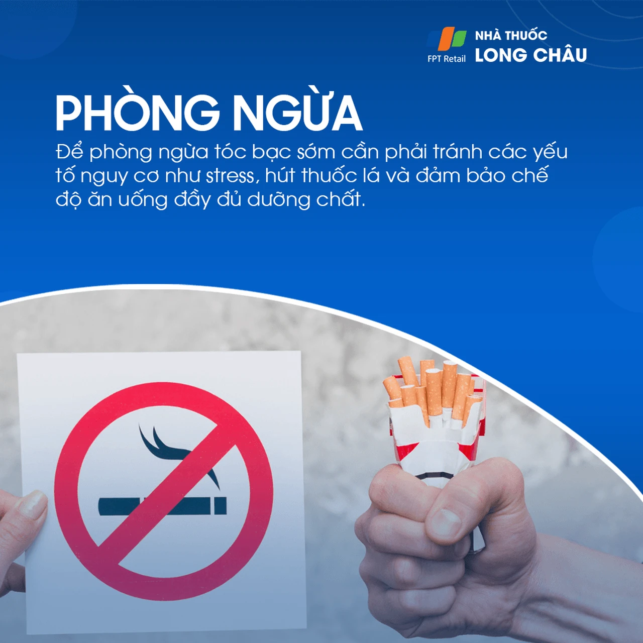 Hình ảnh minh họa