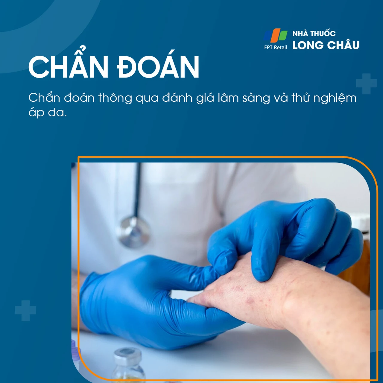 Hình ảnh minh họa