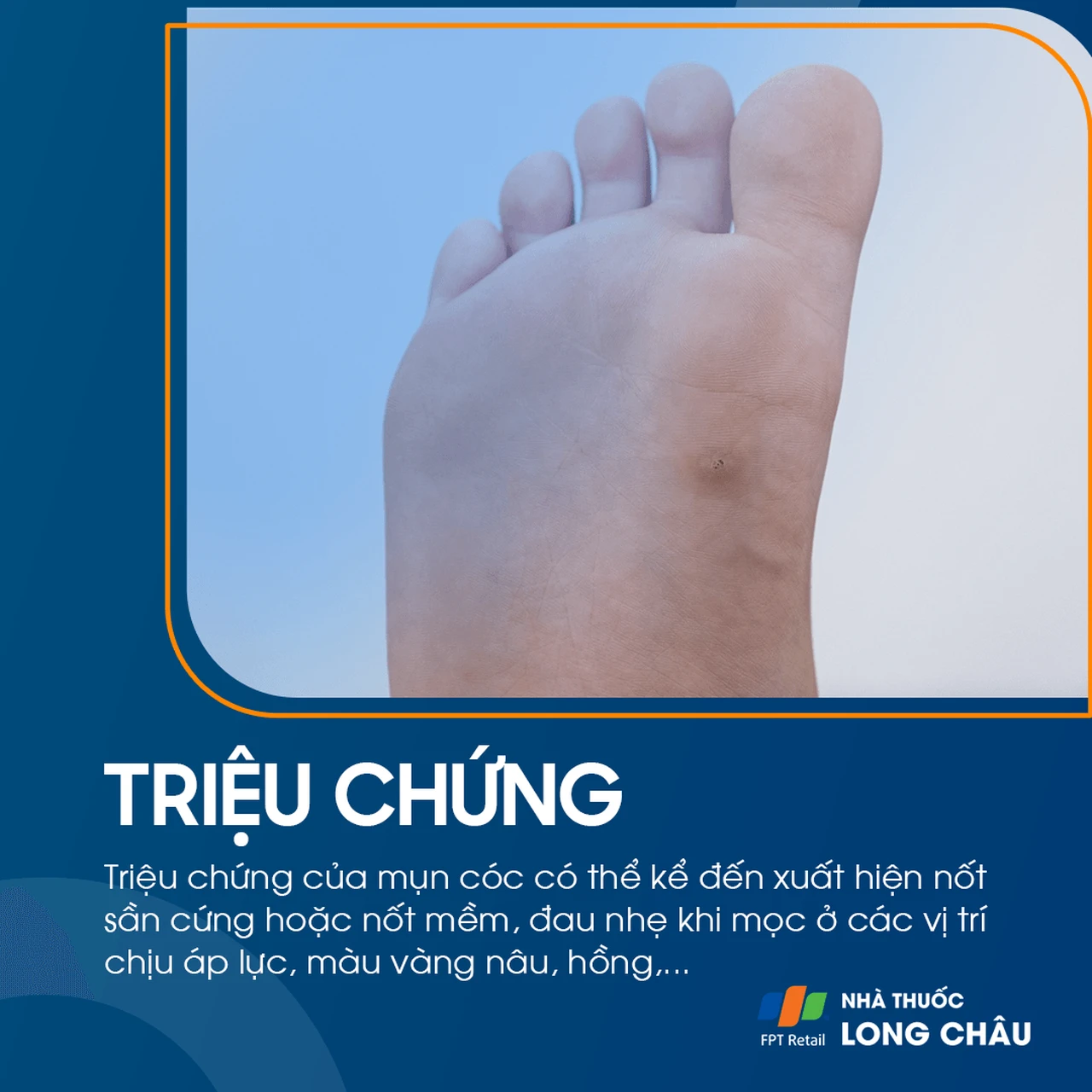 Hình ảnh minh họa