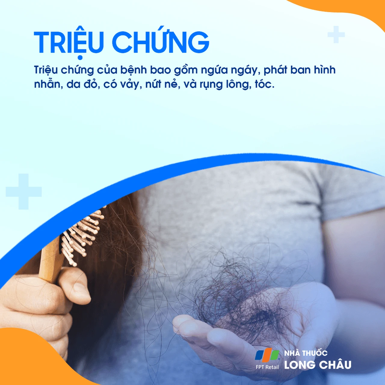 Hình ảnh minh họa