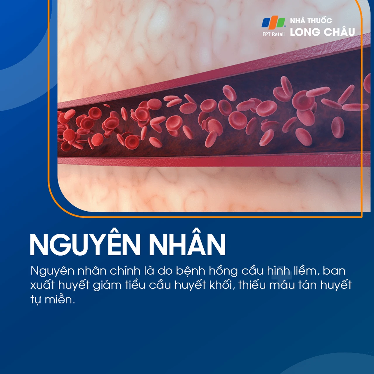 Hình ảnh minh họa