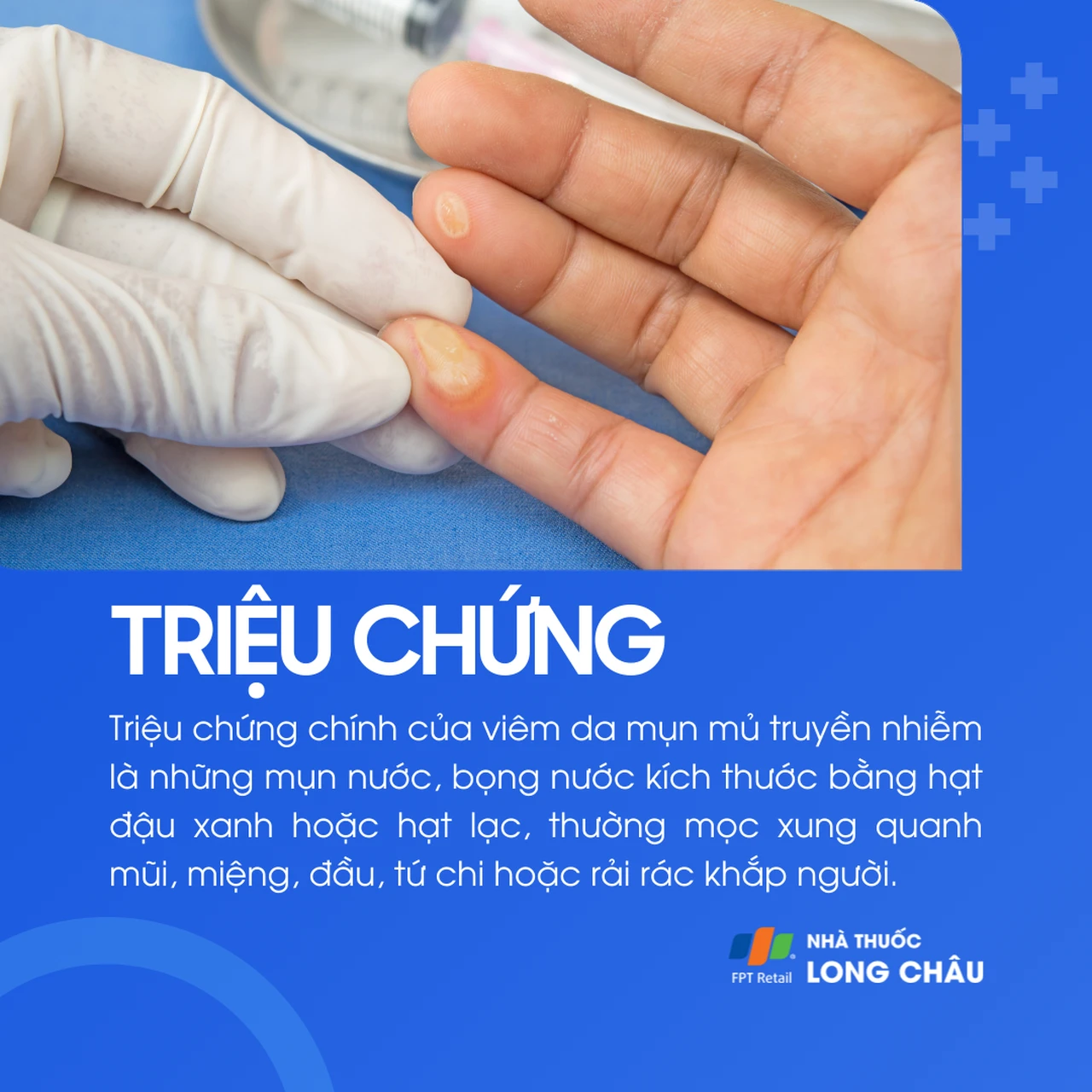 Hình ảnh minh họa
