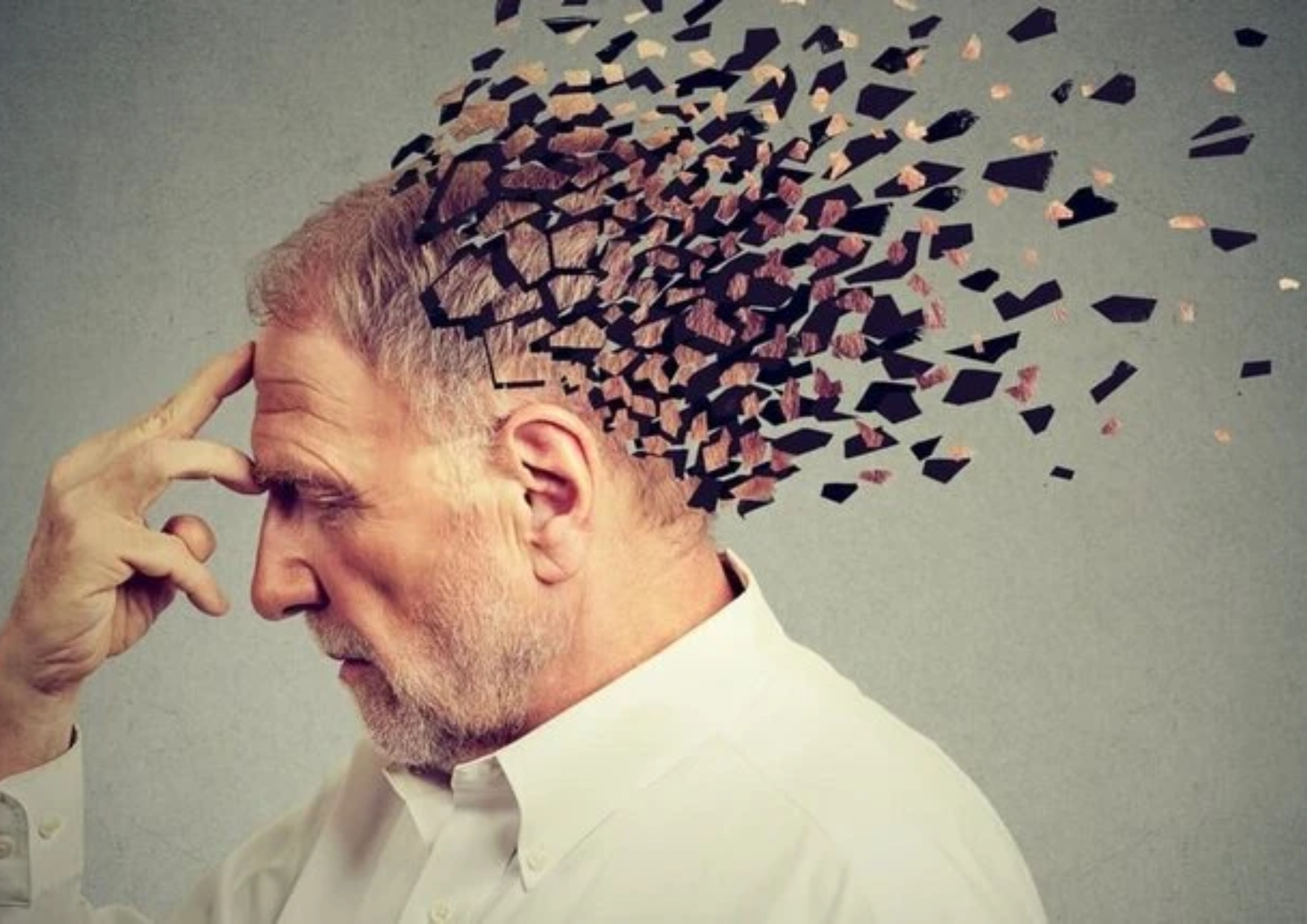 Bệnh Alzheimer là gì? Nguyên nhân, triệu chứng và cách phòng ngừa