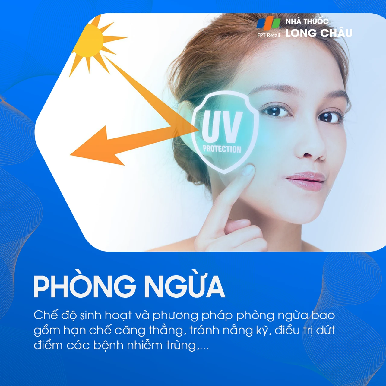 Hình ảnh minh họa