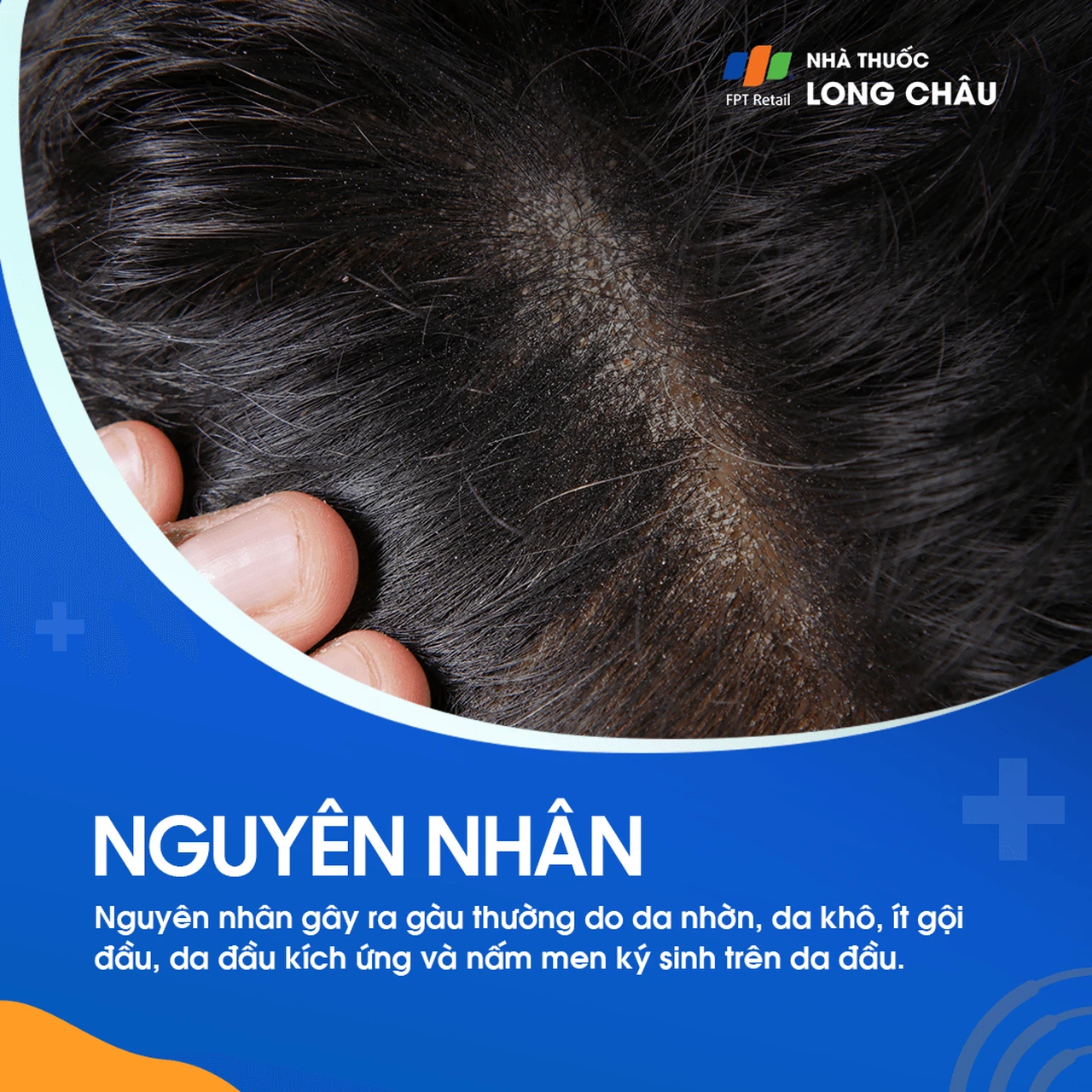 Hình ảnh minh họa