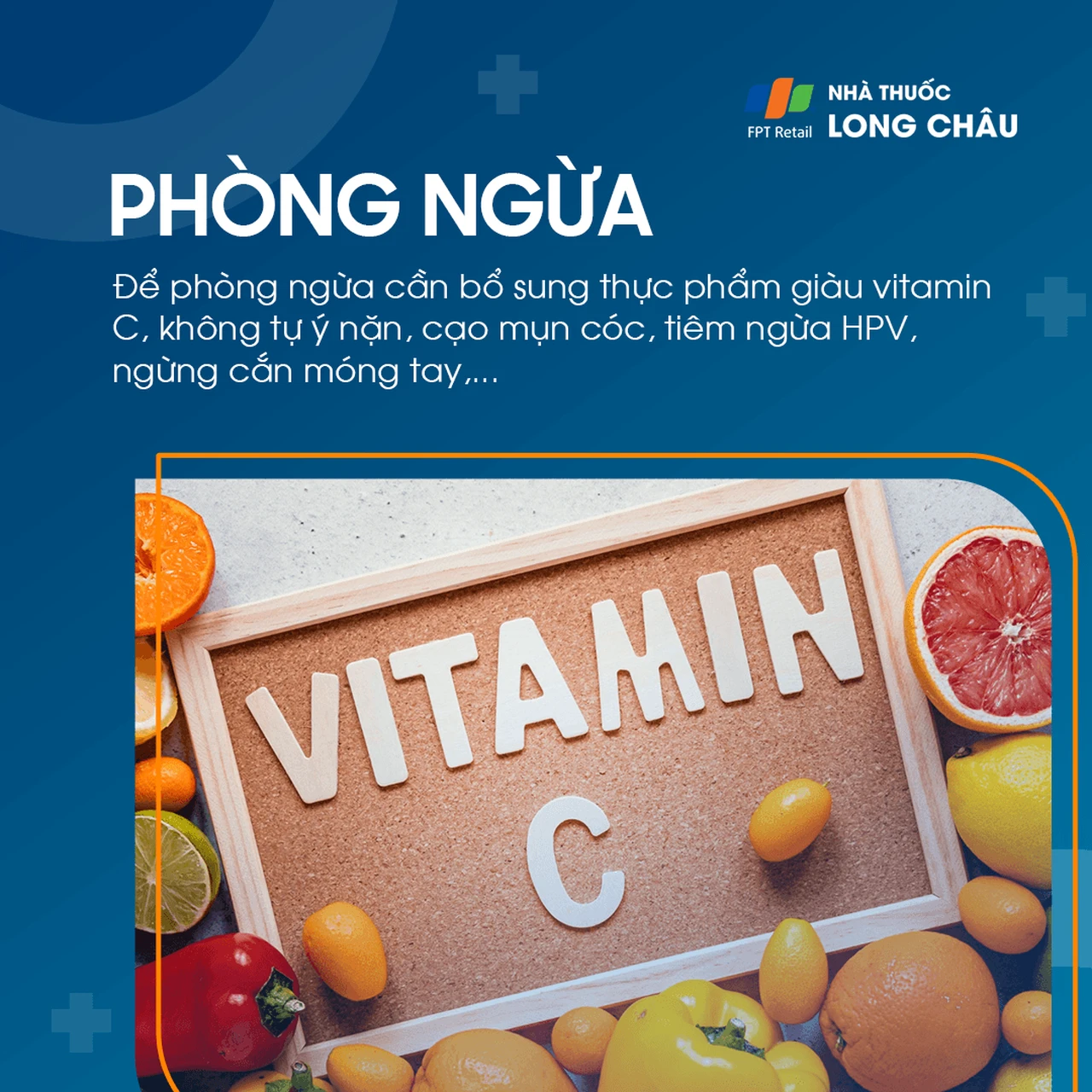 Hình ảnh minh họa