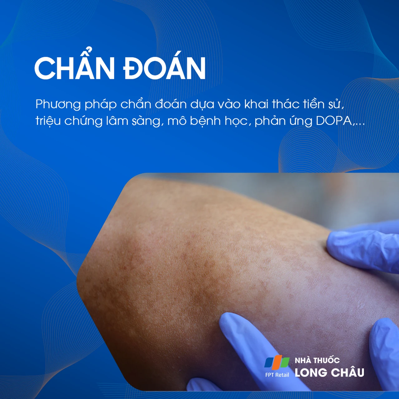 Hình ảnh minh họa