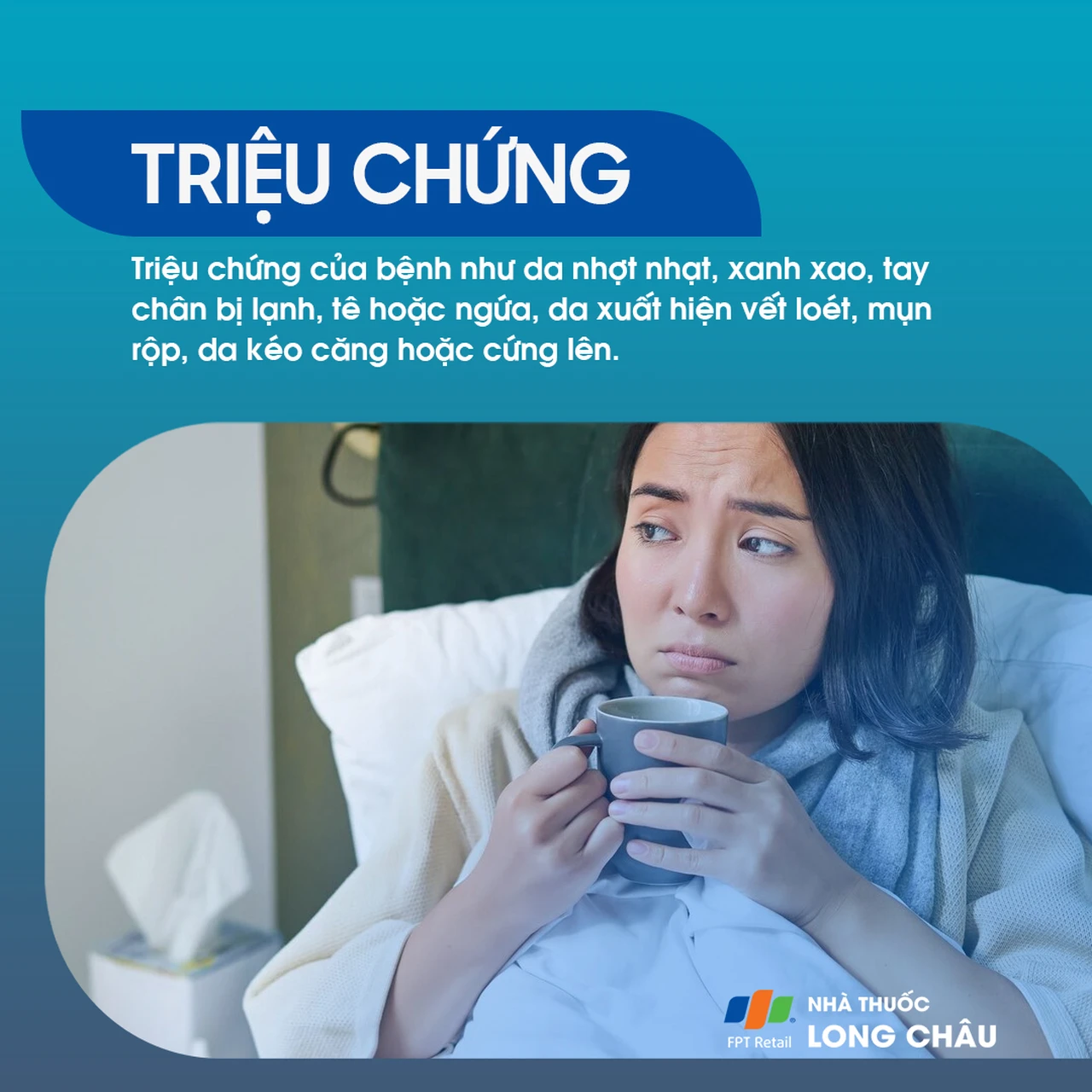 Hình ảnh minh họa