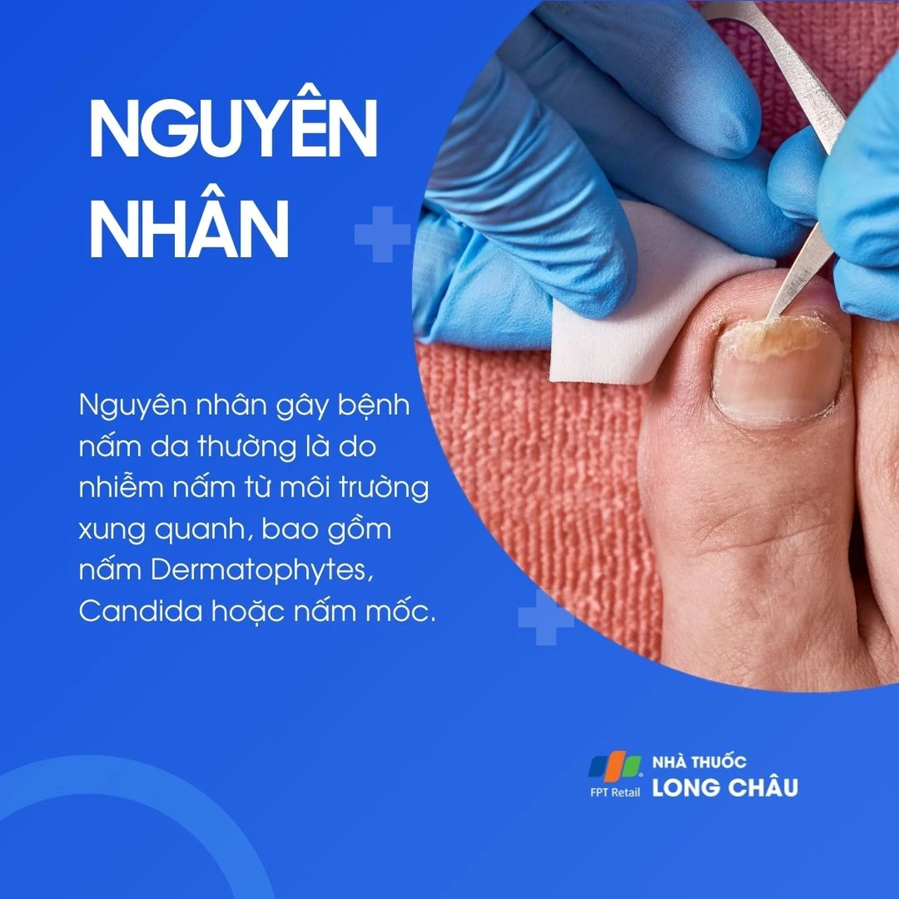 Hình ảnh minh họa