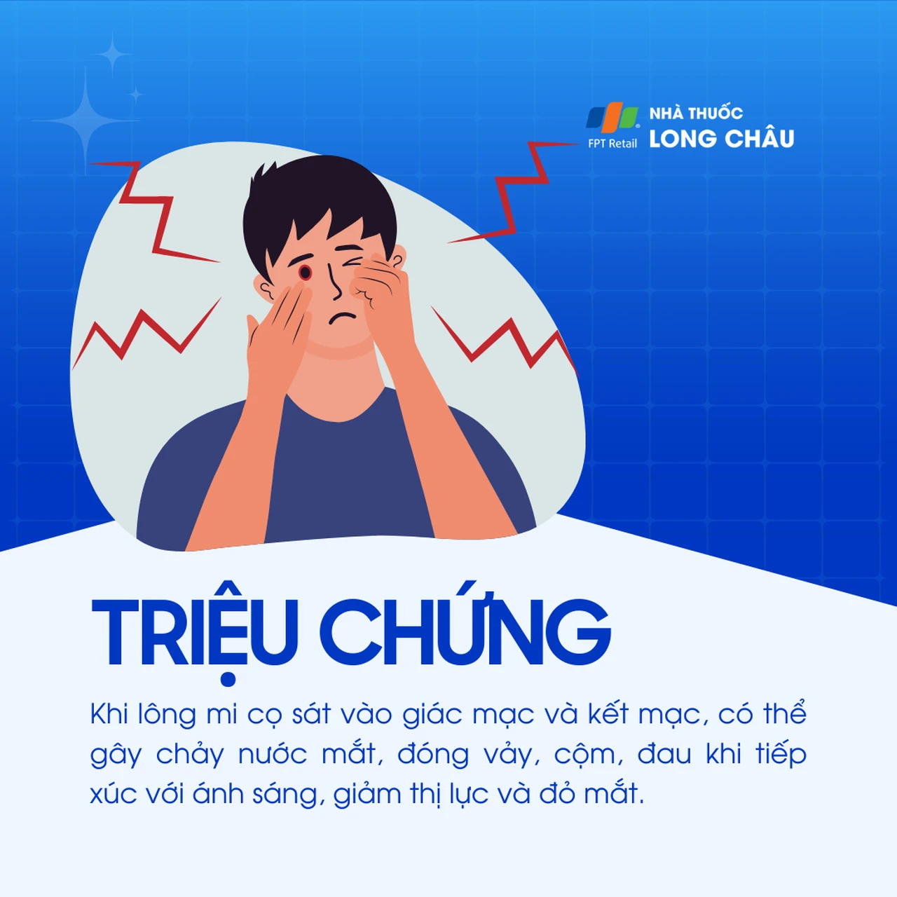 Hình ảnh minh họa
