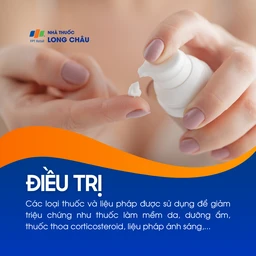 Hình ảnh minh họa