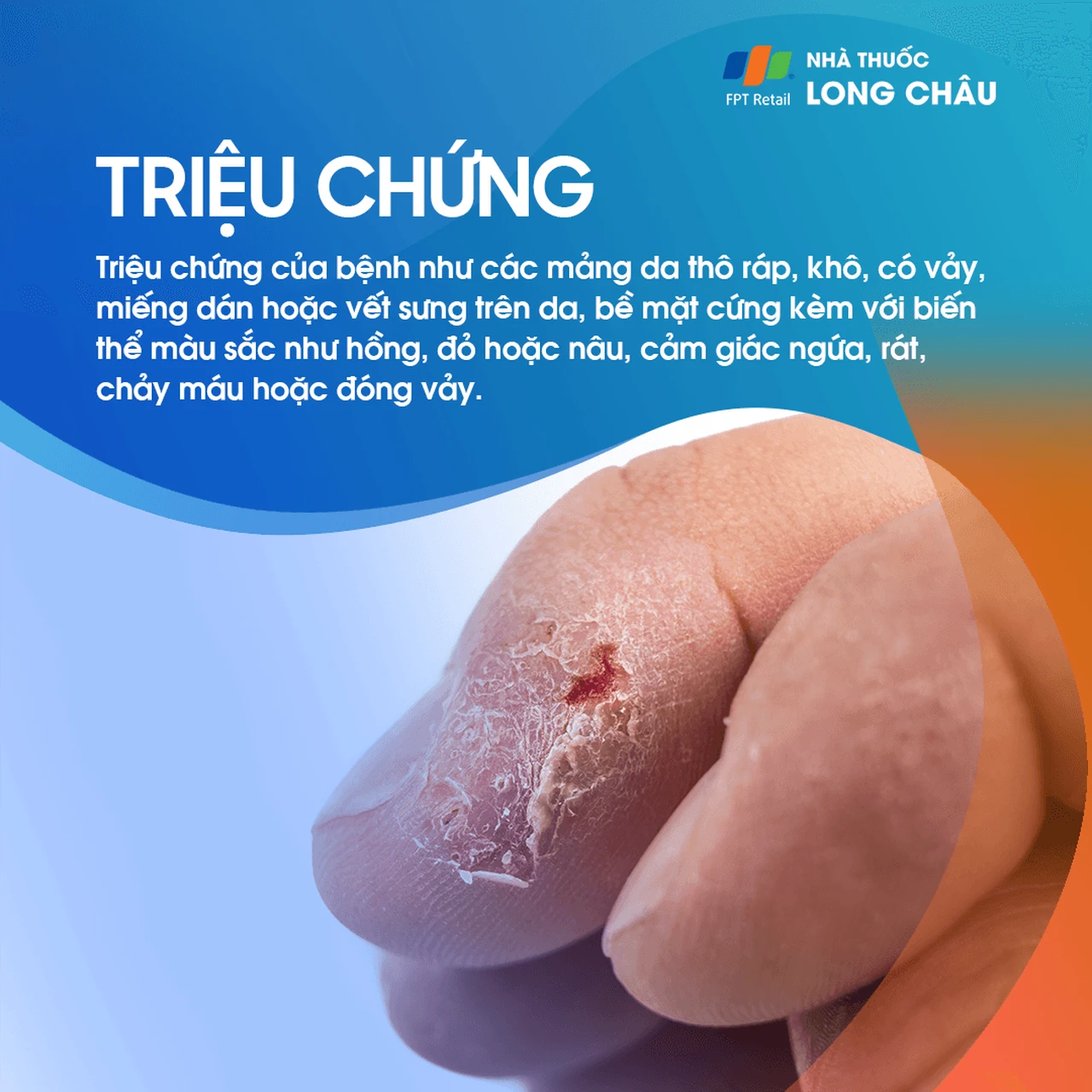 Hình ảnh minh họa