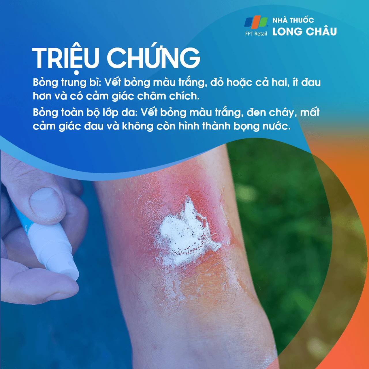 Hình ảnh minh họa