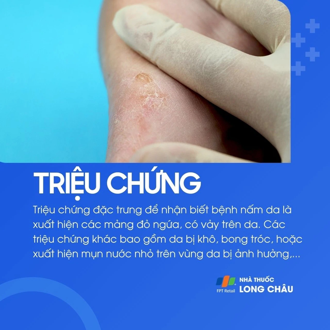 Hình ảnh minh họa