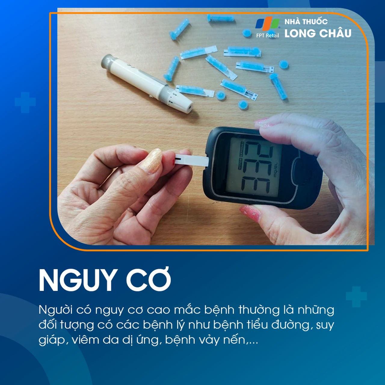 Hình ảnh minh họa