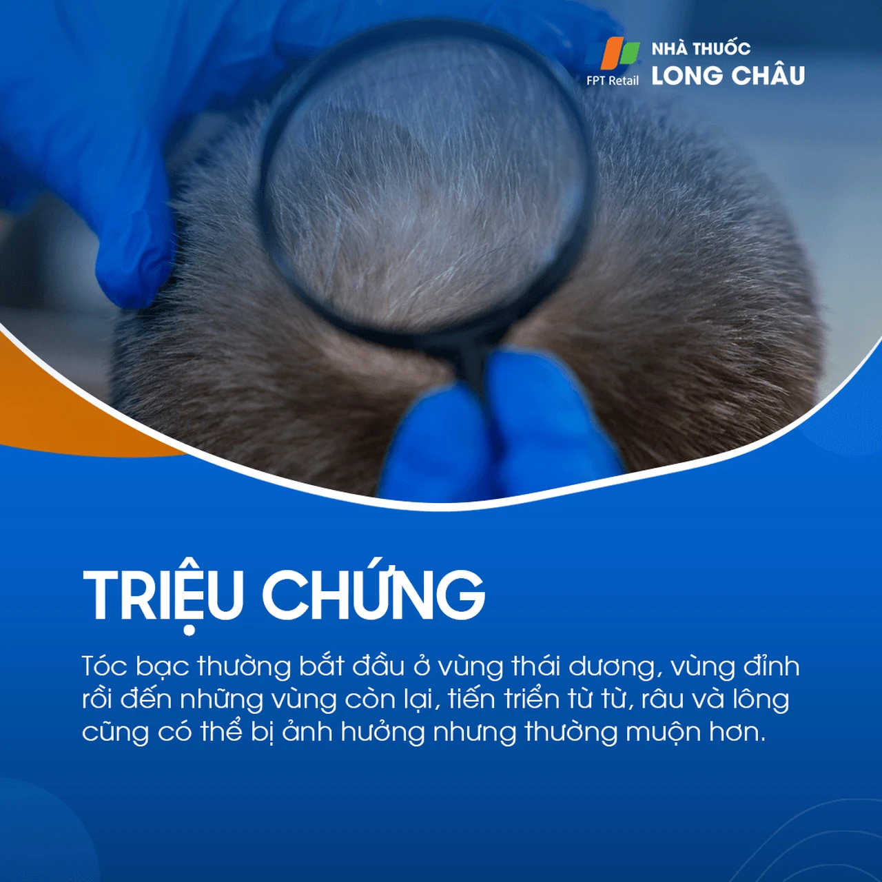 Hình ảnh minh họa