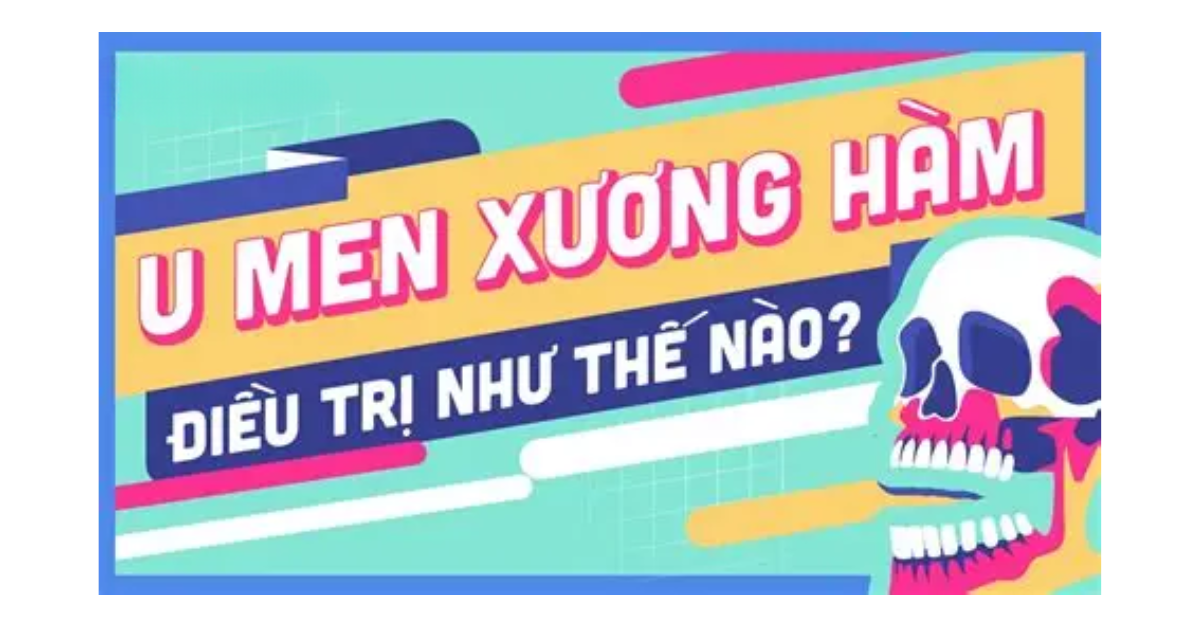 U men xương hàm là gì? Những điều cần biết về u men xương hàm