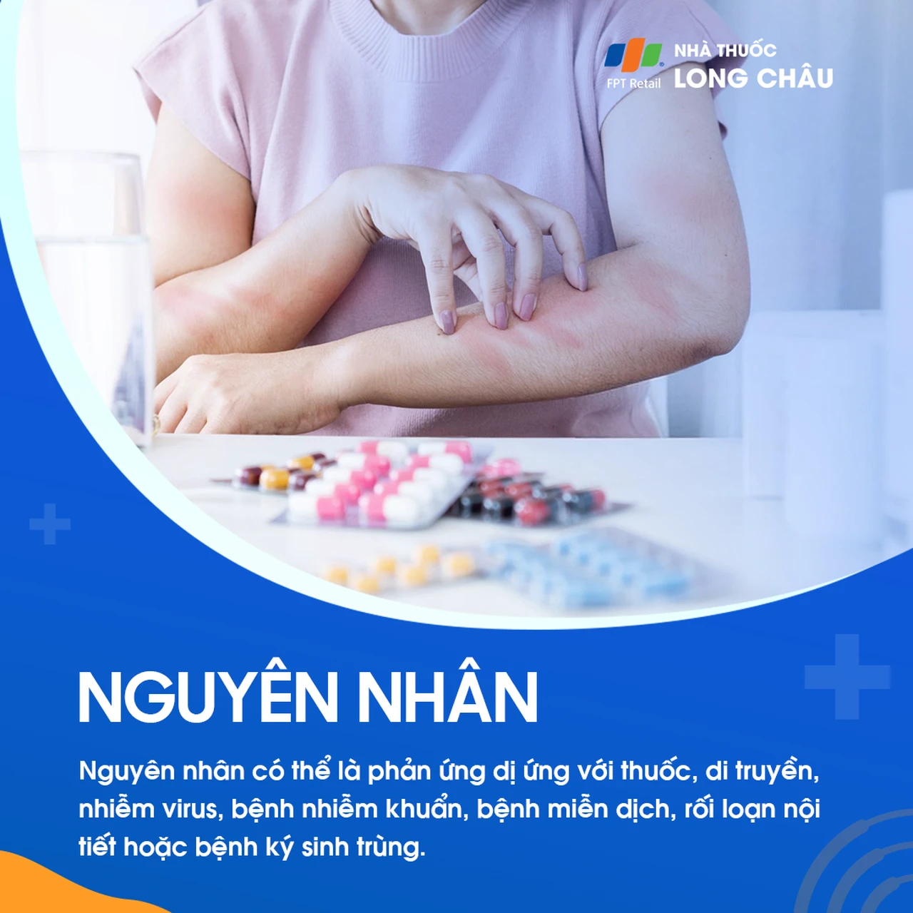 Hình ảnh minh họa