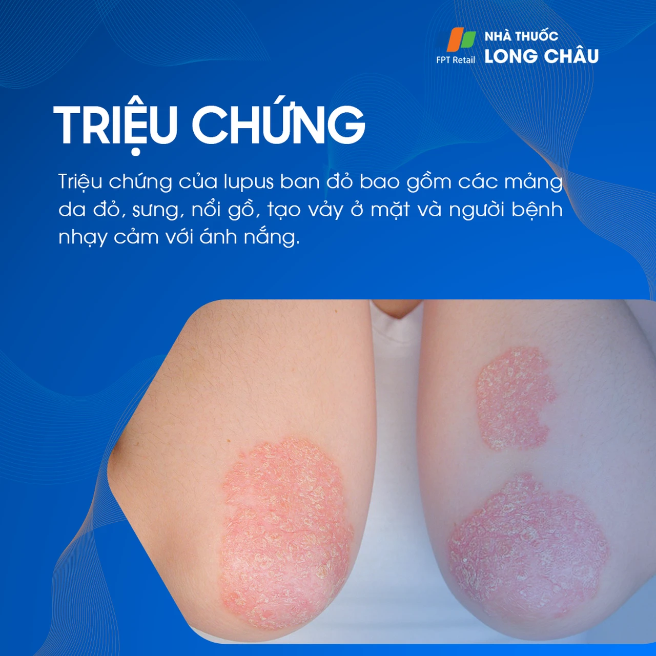 Hình ảnh minh họa