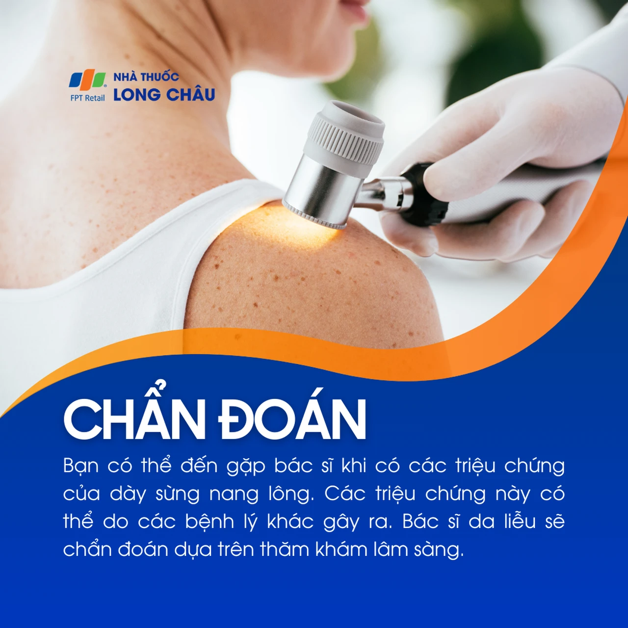 Hình ảnh minh họa