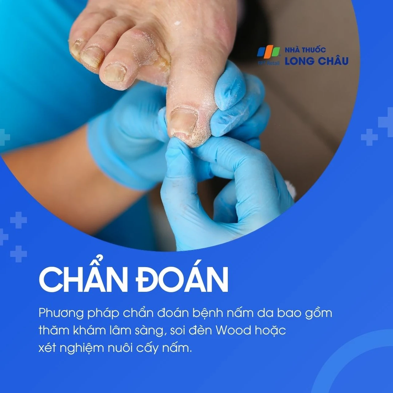 Hình ảnh minh họa
