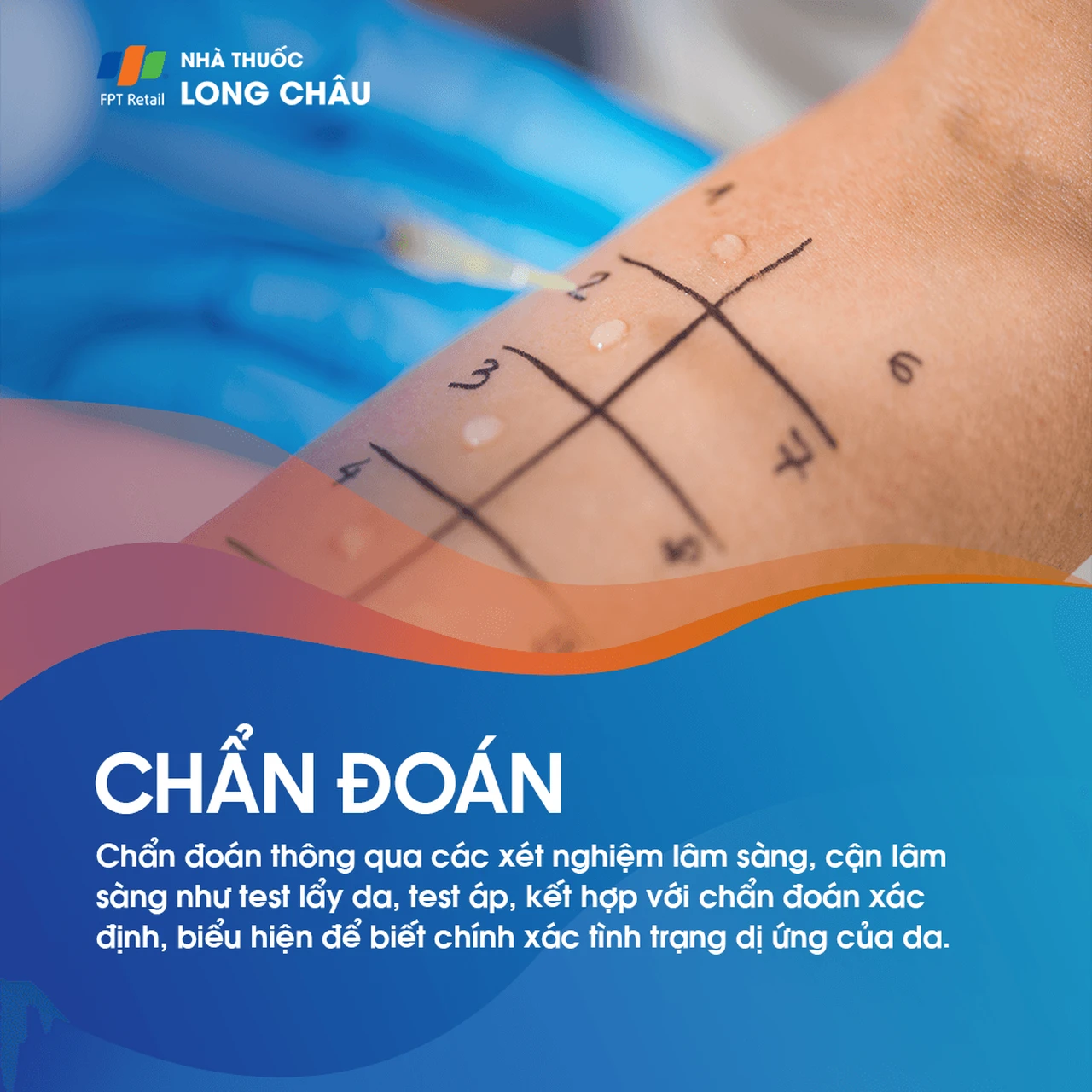 Hình ảnh minh họa