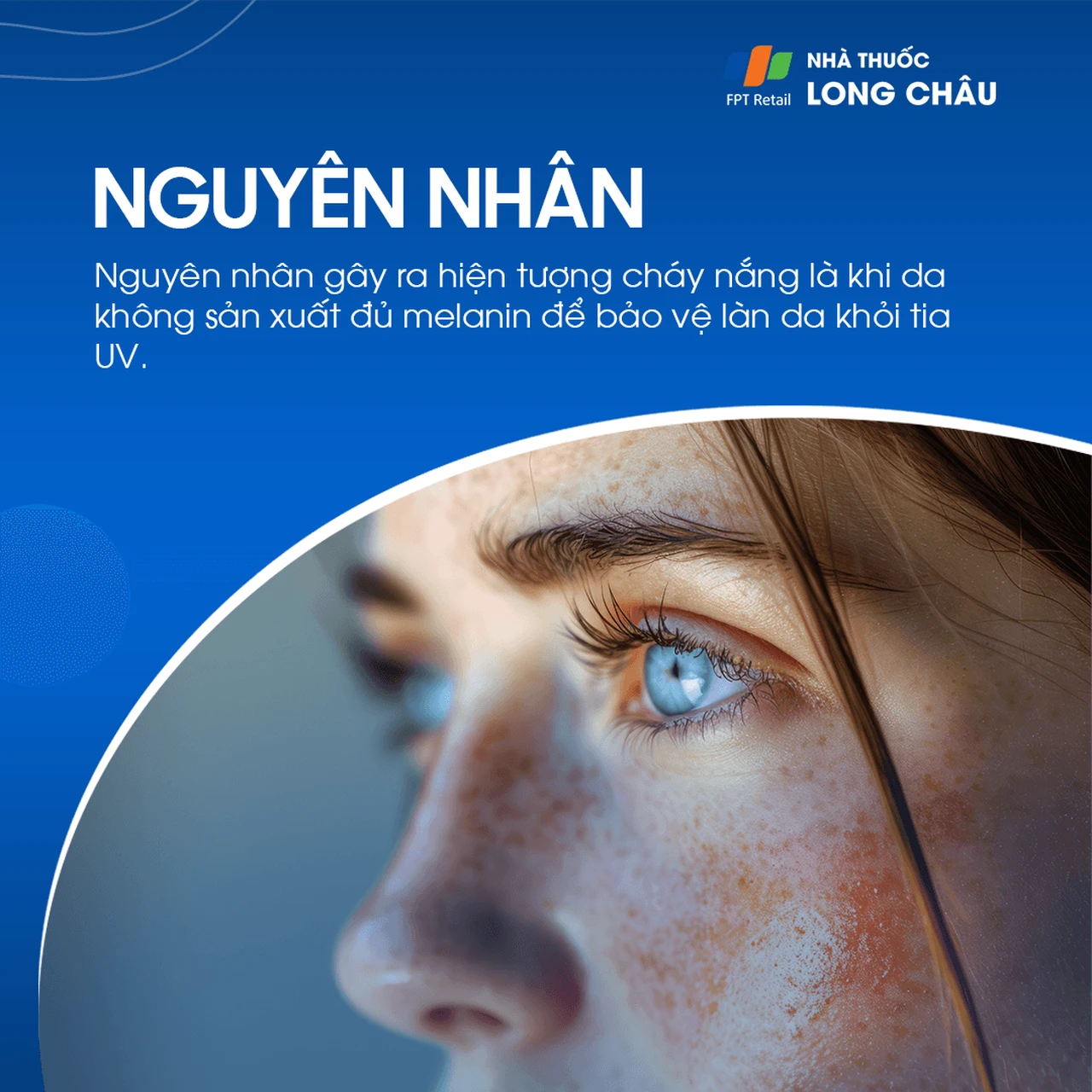 Hình ảnh minh họa