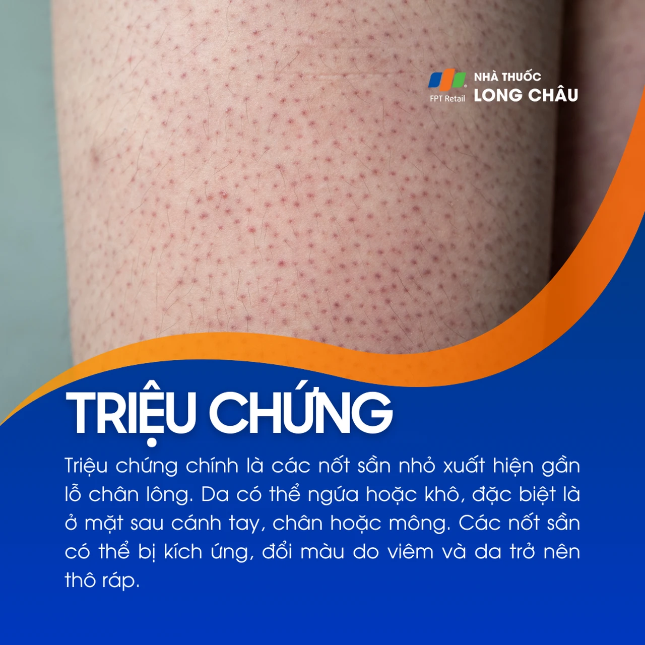 Hình ảnh minh họa