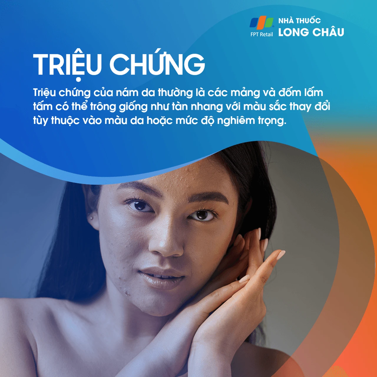 Hình ảnh minh họa